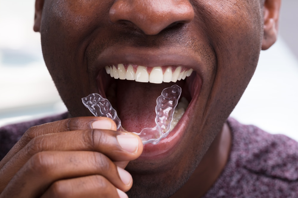 Mouth Guards and Snoring Appliances in Winnipeg