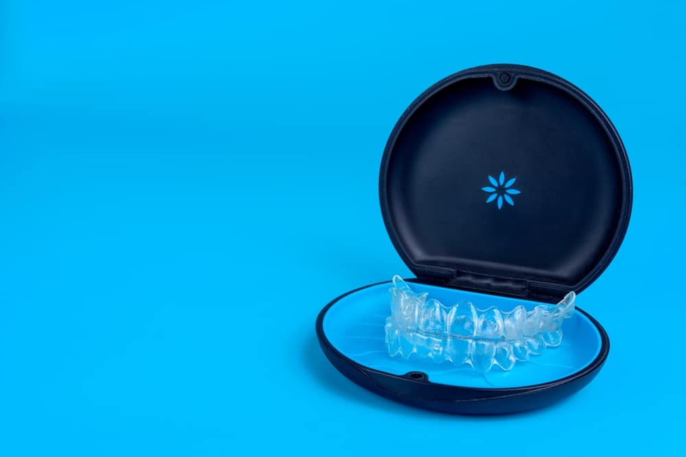 Invisalign clear aligners winnipeg example